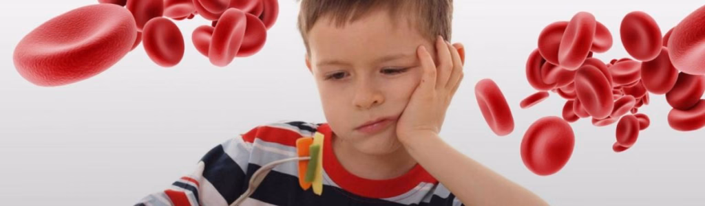 طفل يفقد شهيته و امامه وجبته و محاط بكريات الدم الحمراء دلالة على إصابته بالأنيميا