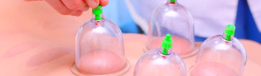 رجل يتلقى العلاج بطريقة العلاج بالحجامة في الطب النبوي